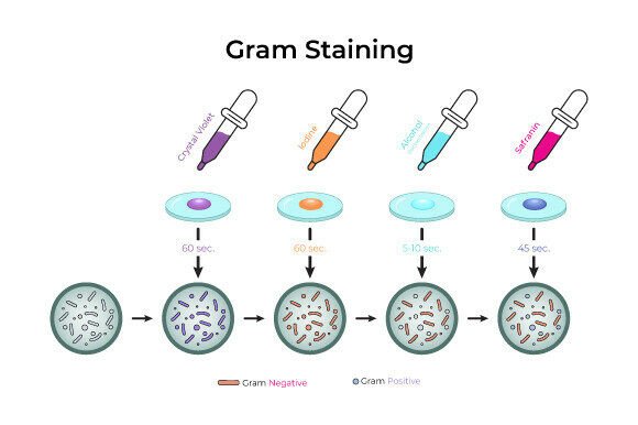 Download Gram Staining Process Diagram Design - Premium Resources